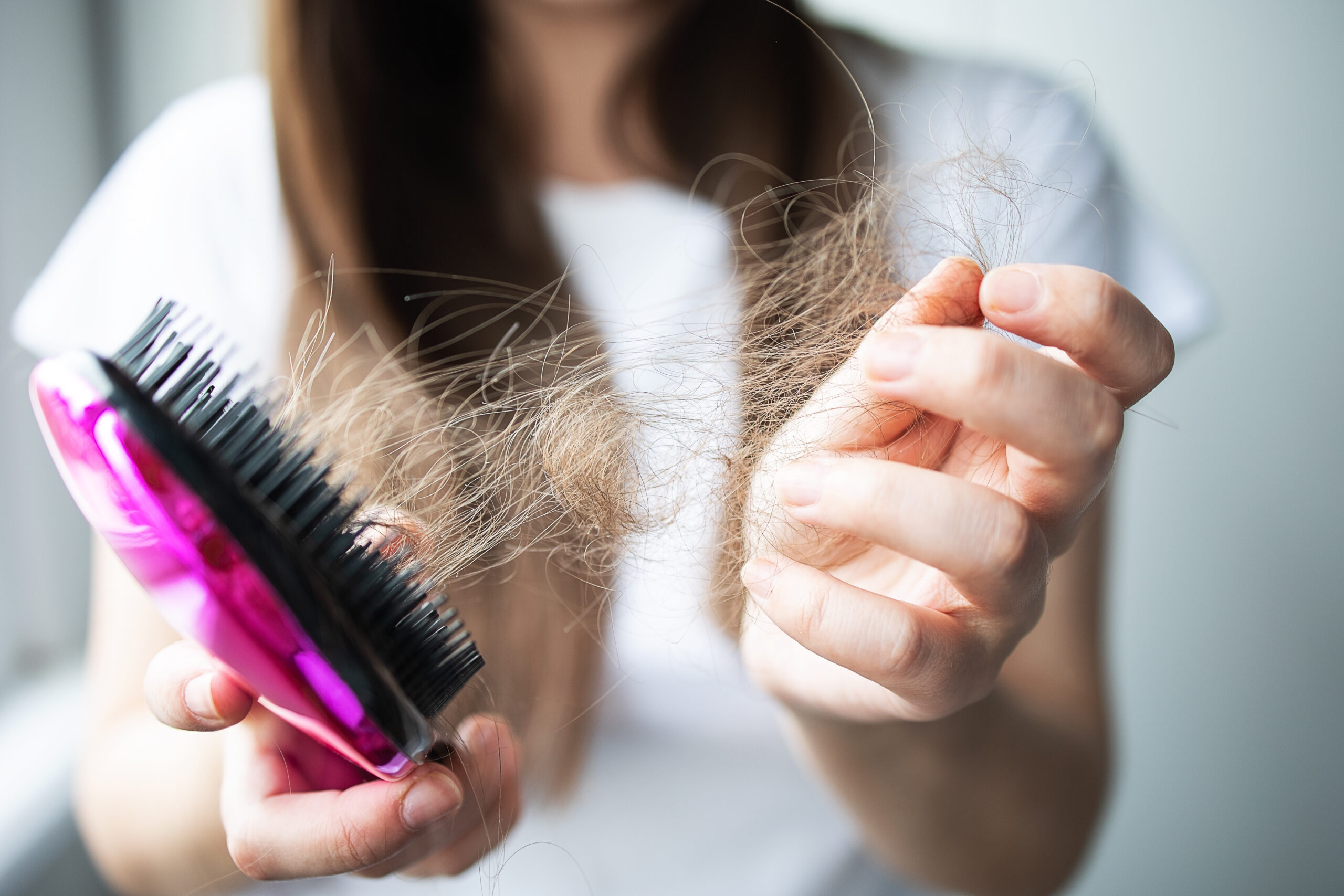 Caída de cabello en mujeres: cómo obtener un diagnóstico correcto y los errores más comunes que retrasan tu recuperación