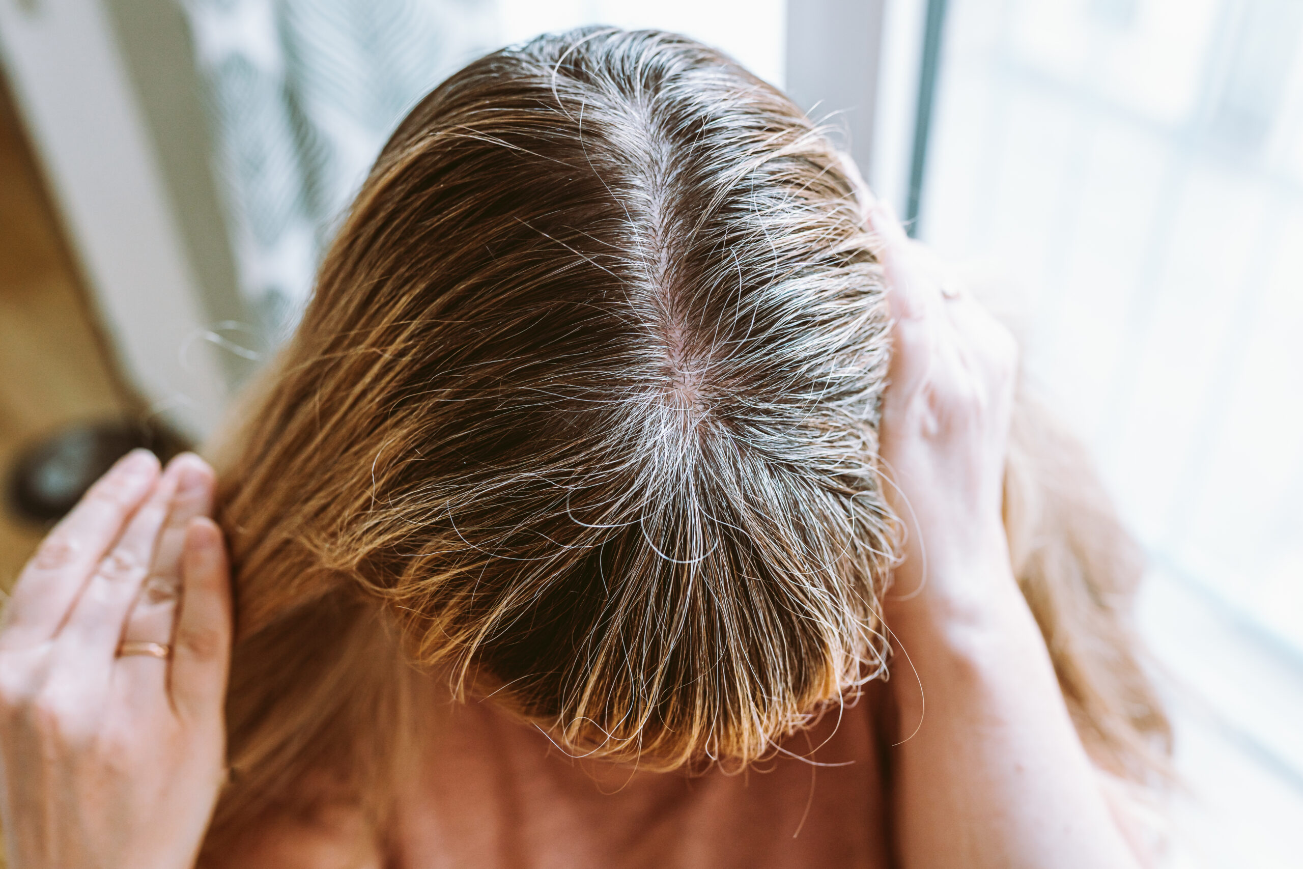 Salud capilar femenina: cómo influyen las hormonas, el estrés y el autocuidado médico en tu cabello