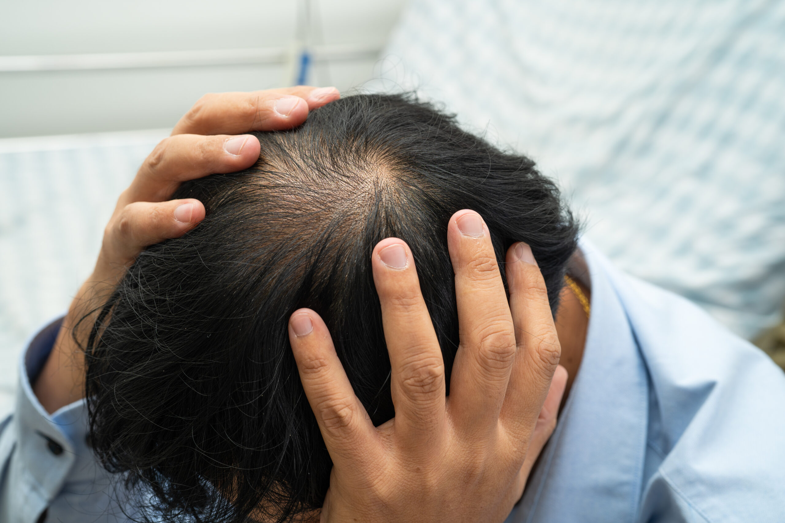 Alergias de primavera: cómo influyen en tu cuero cabelludo y por qué pueden aumentar la caída de cabello
