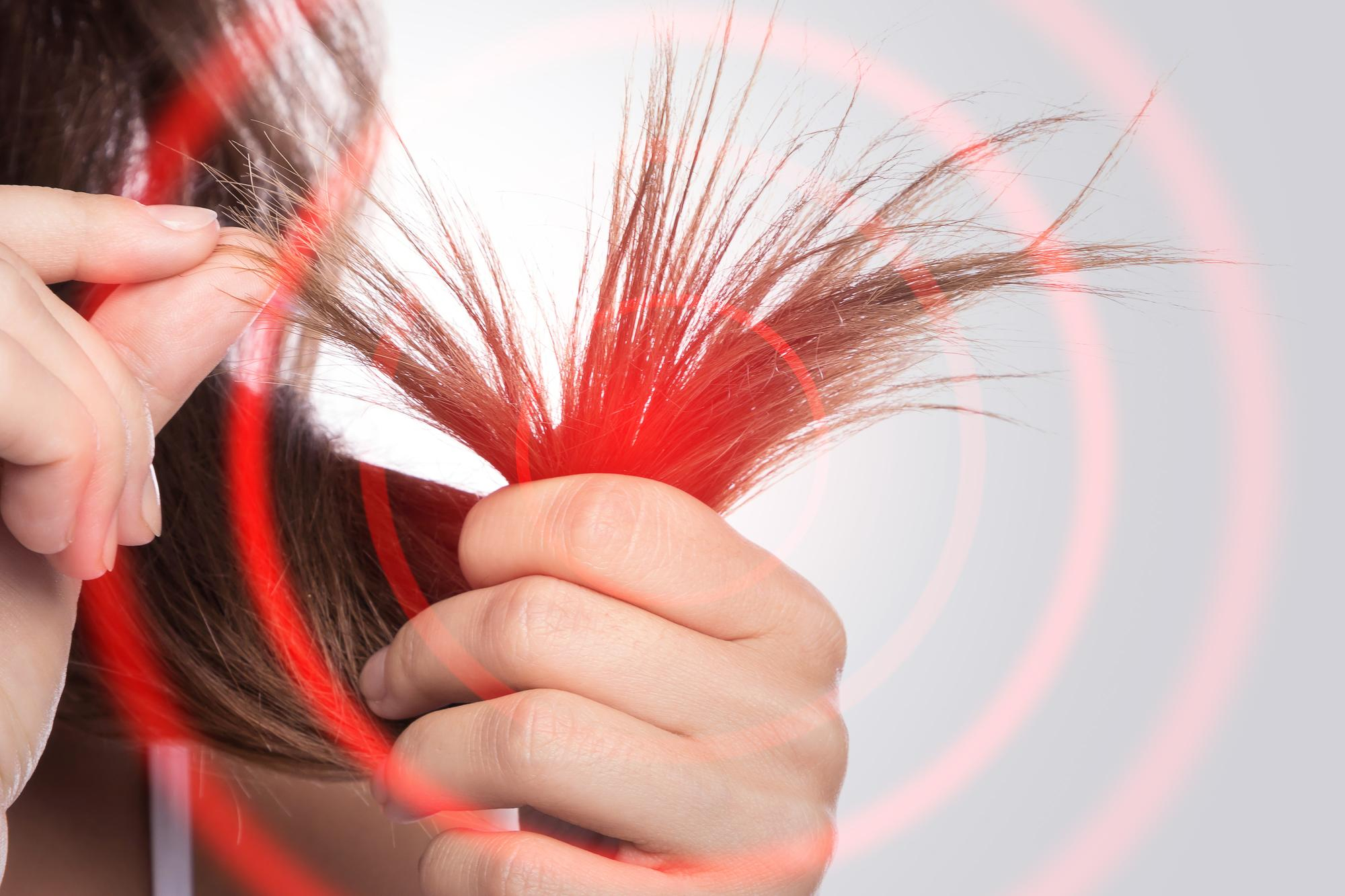 Anemia y caída del cabello: la señal de la ferritina baja